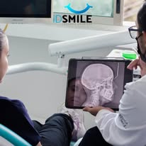 Radiografía dental ID Smile