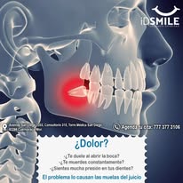 Dolor dental ID Smile