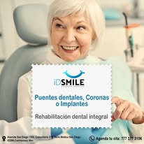 Puentes coronas e implantes ID Smile
